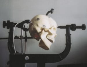 skull-adjusted