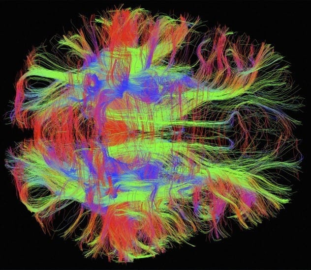 Photo by Wellcome Images.