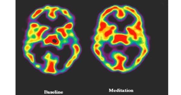 This is Your Brain on Mindfulness Lion's Roar