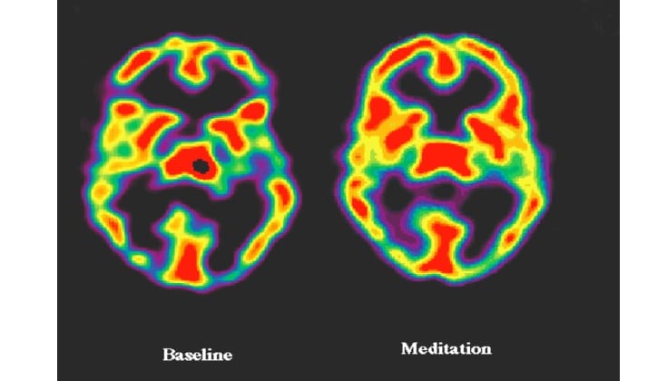 Impacts of Meditation on Brain